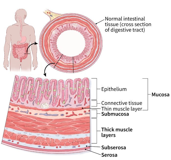 illustration showing normal intestinal tissue with a cross section of the digestive tract and detail showing mucosa (epithelium, connective tissue, thin muscle layer), submucosa, thick muscle layers, subserosa and serosa