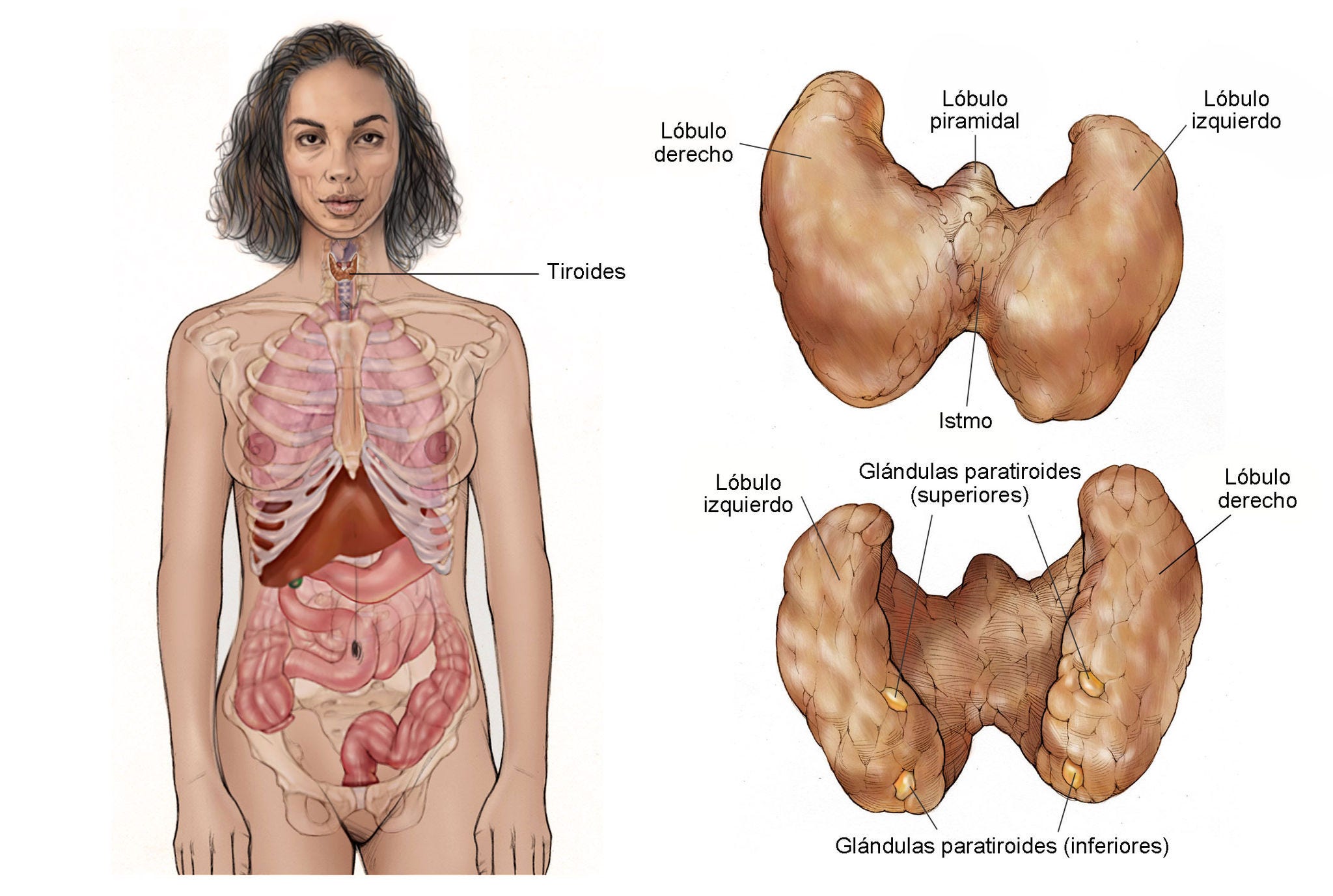 Ilustración del cuerpo de una mujer en la que se muestra dónde se encuentra la glándula tiroides. También se incluyen dos perspectivas de la glándula tiroides, agrandada y con etiquetas de los lóbulos izquierdo y derecho, del istmo, del lóbulo piramidal y de las glándulas paratiroides (superiores e inferiores).