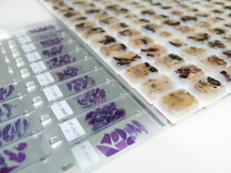 Stained microscope slides and biopsy tissue in paraffin blocks