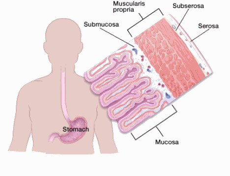 illustration showing the stomach with a detailed cross-section of its layers: the mucosa, submucosa, muscularis propria, subserosa and serosa