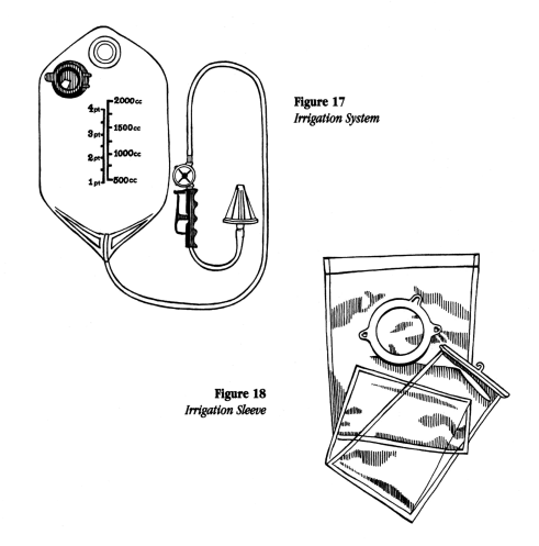 illustration showing an irrigation system and sleeve