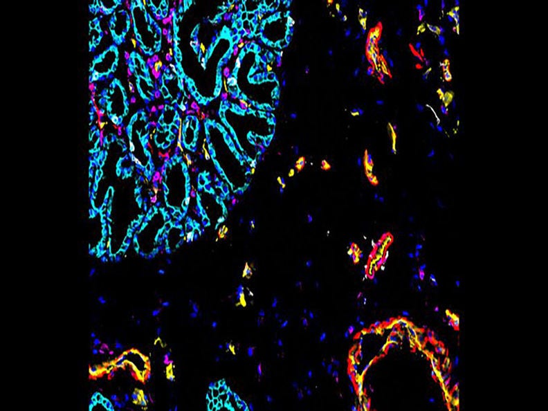 Codex of intestine image by John Hickey, PhD