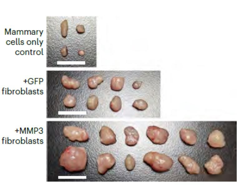 These images compare breast cells from mice without cancer (top) with tumors dissected after 6 weeks of growth in mice with normal fibroblasts (middle) and tumors dissected in the same amount of time in mice with MMP3 fibroblasts (bottom). Tumors developed more frequently in the +MMP3 group, demonstrating that fibroblast-derived MMP3 promotes BRCA1-mutated tumors in vivo. 