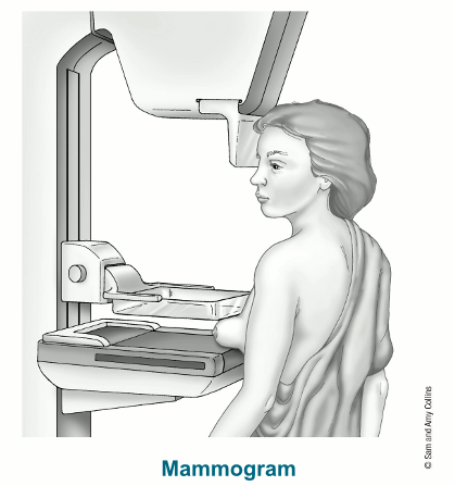 illustration showing a woman getting a mammogram