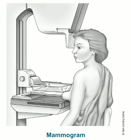 Breast Cancer Mammogram, How Does a Mammogram Work?