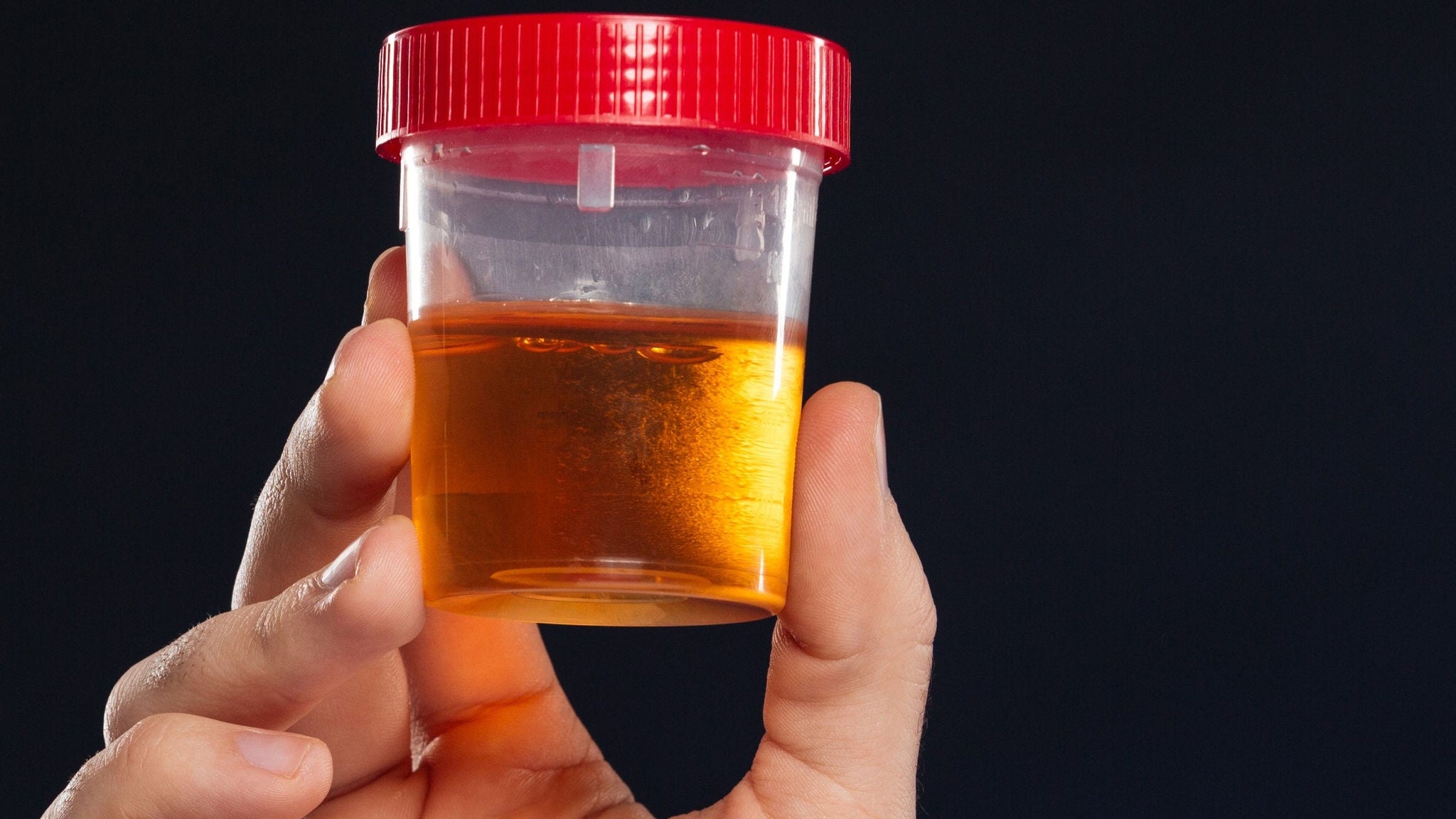 Close up of male's hand holding container with urine sample isolated over dark background