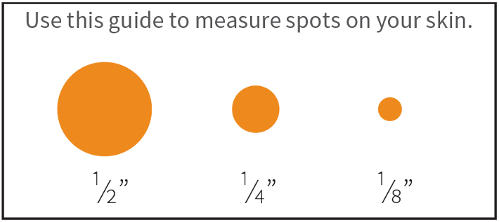 a guide to measure spots on your skin