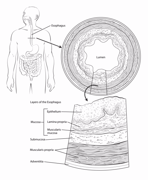 illustration showing the location of the esophagus in the body as well as a detailed cross section showing the layers of the esophagus including the mucosa (epithelium, lamina propria, muscularis mucosa), submucosa, muscularis propria and adventitia