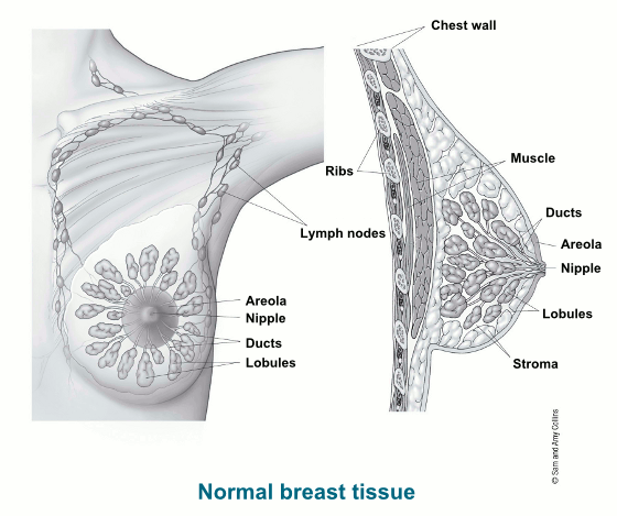 What Is Breast Cancer?  American Cancer Society