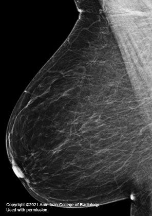 Measuring breast density