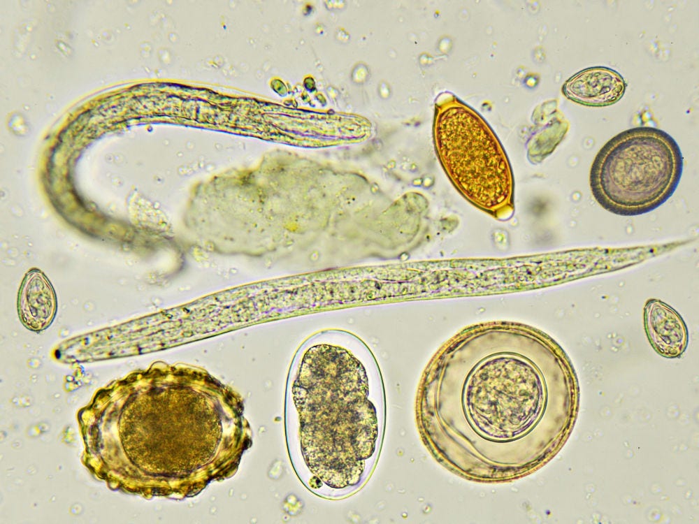 picture of O. viverrini parasite under a microscope