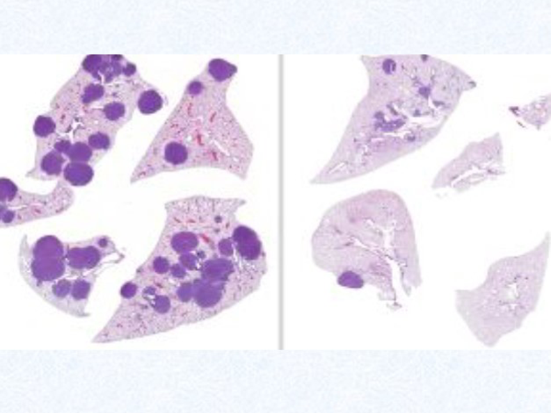 tumors with dark purple circles on left and fewer dark markings on right