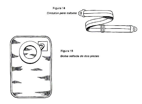 ostomy-belt-and-closed-pouch-spanish.gif