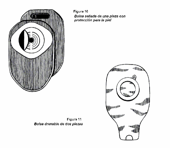 colostomy-closed-end-and-drainable-pouch-spanish.gif