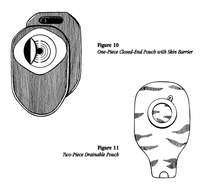 illustration showing two types of pouching systems: a one-piece closed-end pouch with skin barrier and a two-piece drainable pouch