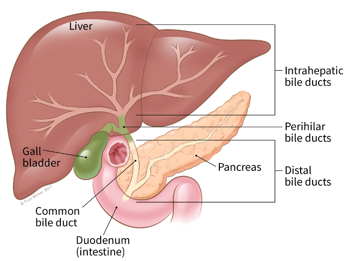 illustration showing the location of the common bile duct, intrahepatic bile ducts, perihilar bile ducts and distal bile ducts in relation to the liver, pancreas, gallbladder and duodenum (intestine)