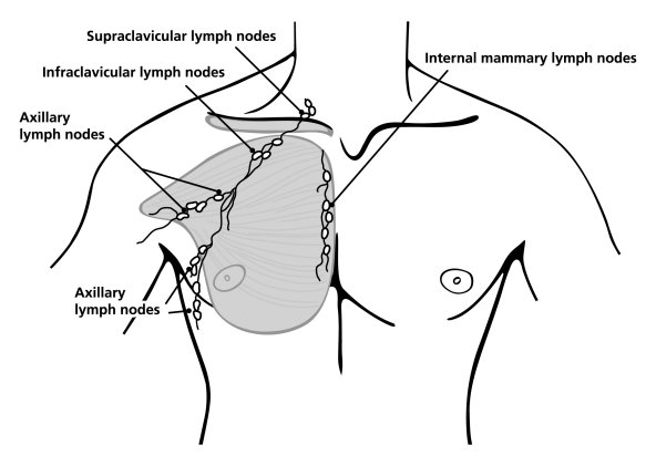 illustration showing lymph nodes in the male breast including location of the supraclavicular, infraclavicular, axillary and internal mammary lymph nodes