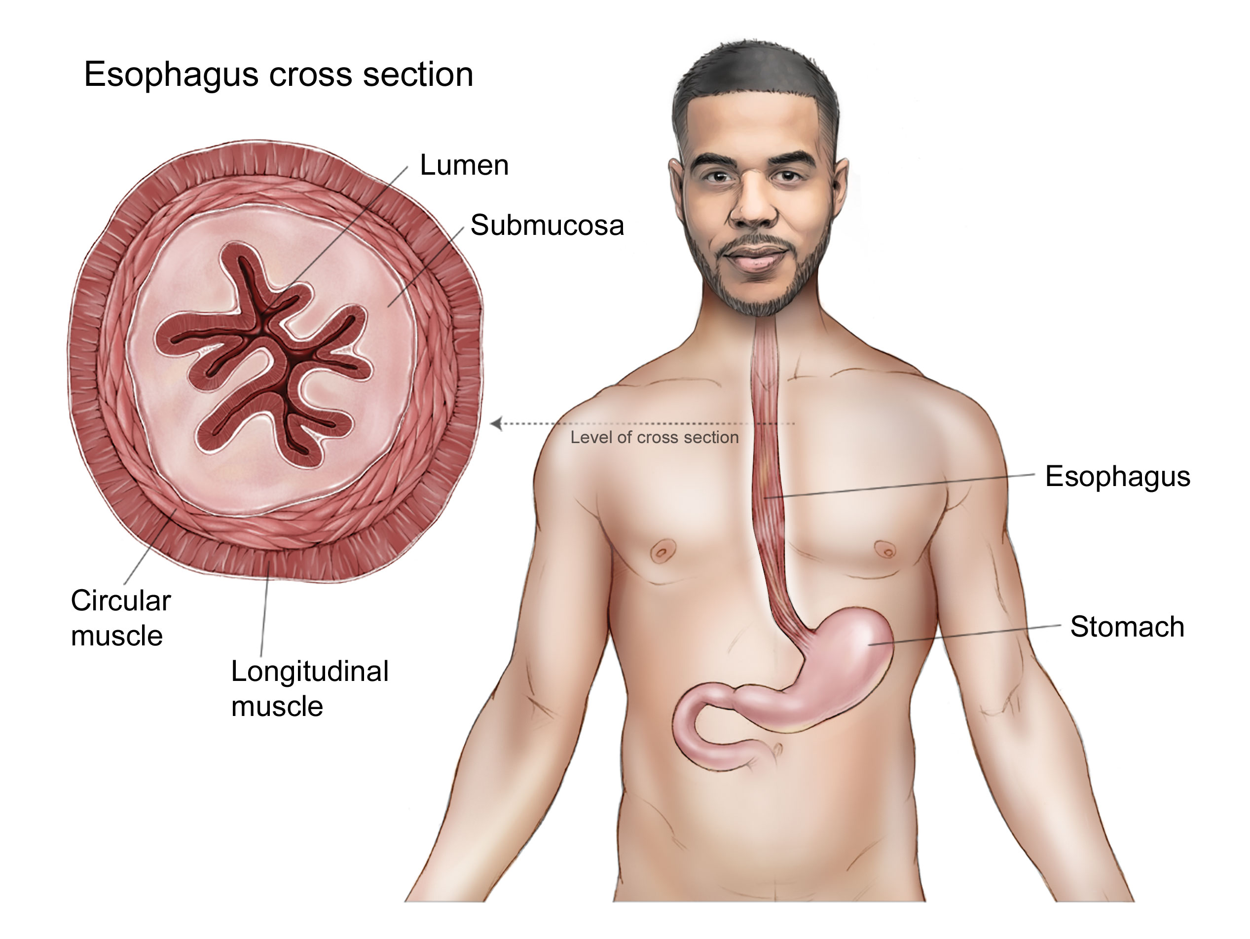 illustration showing the location of the esophagus in the body as well as a detailed cross section showing the layers of the esophagus including the mucosa (epithelium, lamina propria, muscularis mucosa), submucosa, muscularis propria and adventitia