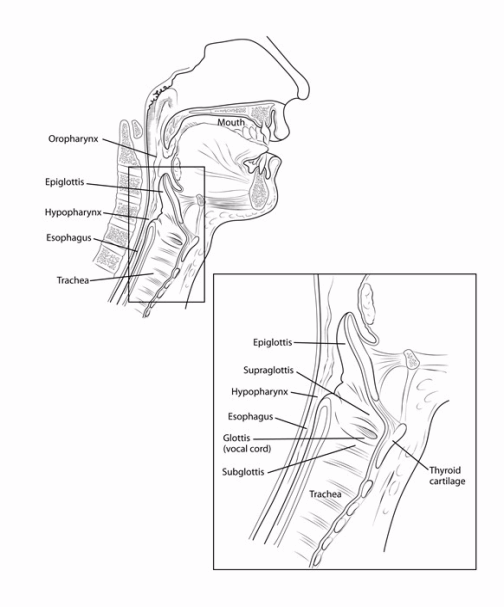 illustration showing location of the oropharynx, epiglottis, hypopharynx, esophagus and trache with a window showing more detailed view including the epiglottis, supraglottis, hypopharynx, esophagus, glottis (vocal cord), subglottis, thyroid cartilage and trachea