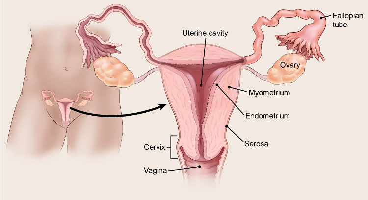 Endometrial cancer is Endometrial cancer lymph nodes