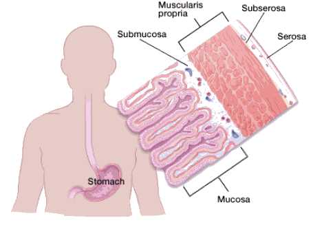 abdominal cancer period papiloma escamoso lingua