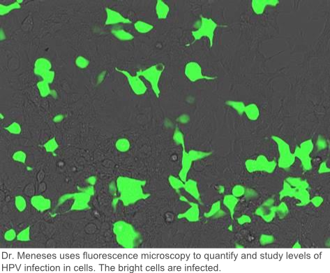 fluorescence microscopy large caption