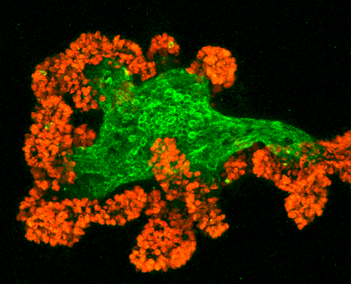 mouse intestinal organoid that Lukas Dow, PhD, uses to study a subtype of colorectal cancer