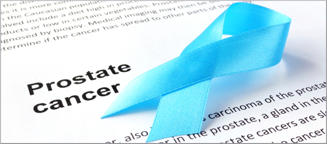 prostate cancer screening guidelines acs