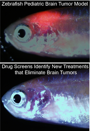 Zebrafish Brain Tumors  