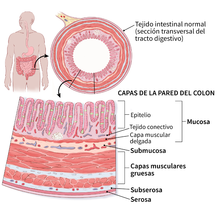 illustration showing a cross section of the digestive tract (normal intestinal tissue) and details of the layers of the colon wall (including the mucosa (epithelium, connective tissue, thin muscle layer), submucosa, thick muscle layers, subserosa and serosa)