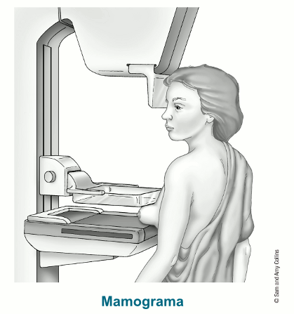 Ilustración de mamograma
