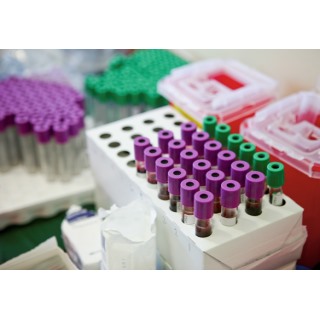 test tubes with purple and green lids in holder